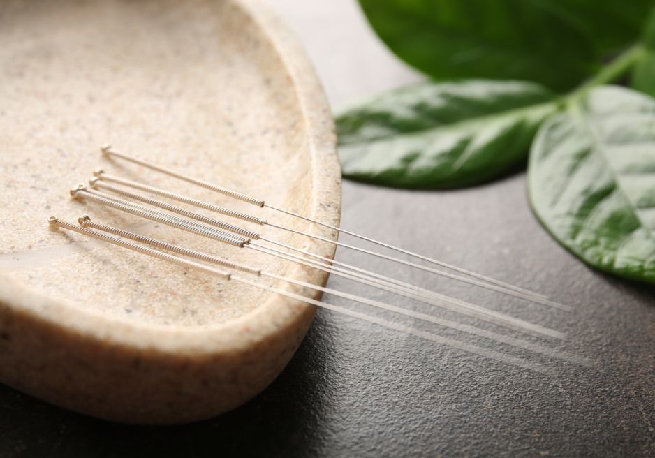 Acupunctură București