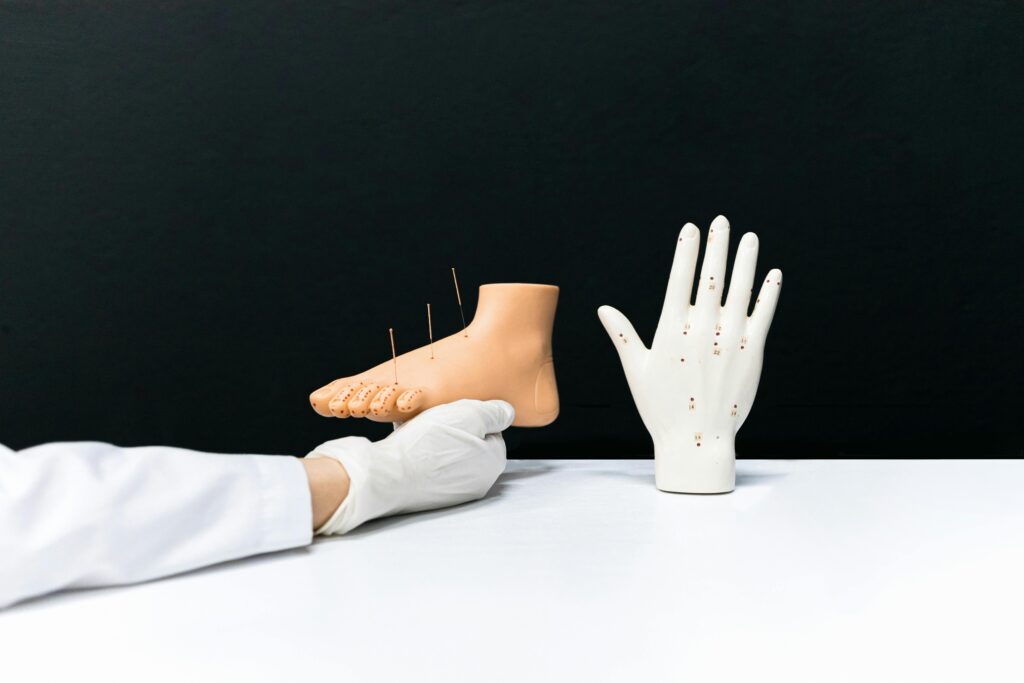 acupunctura medicala spitale china
